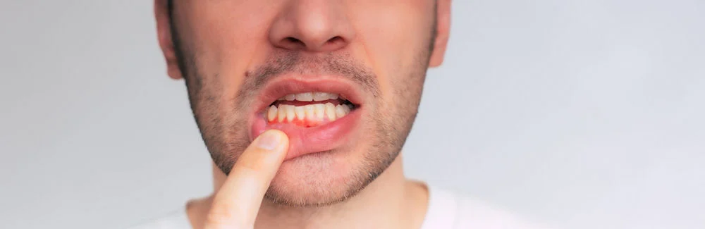 Effects of Substance Abuse on Teeth