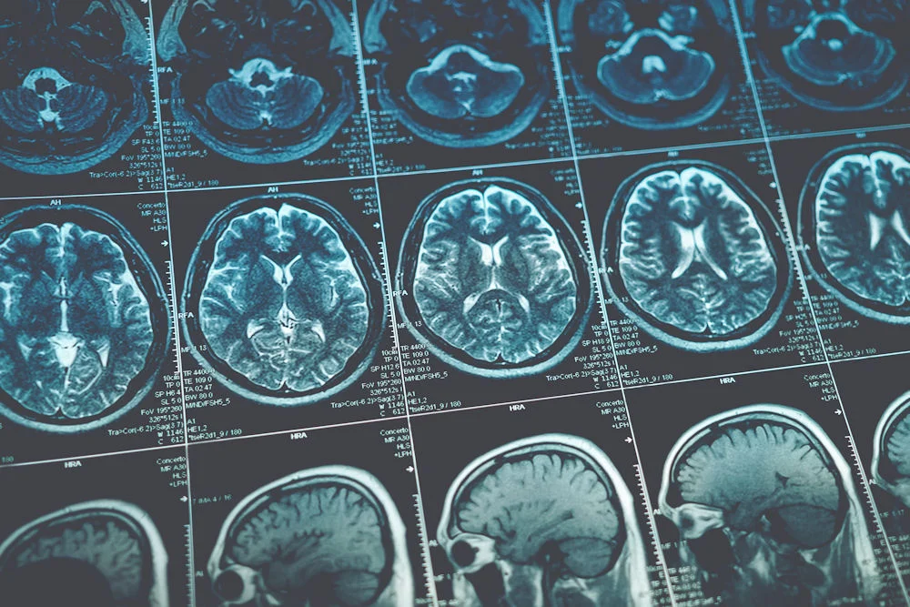 brain damage from drugs