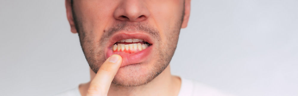 Effects of Substance Abuse on Teeth